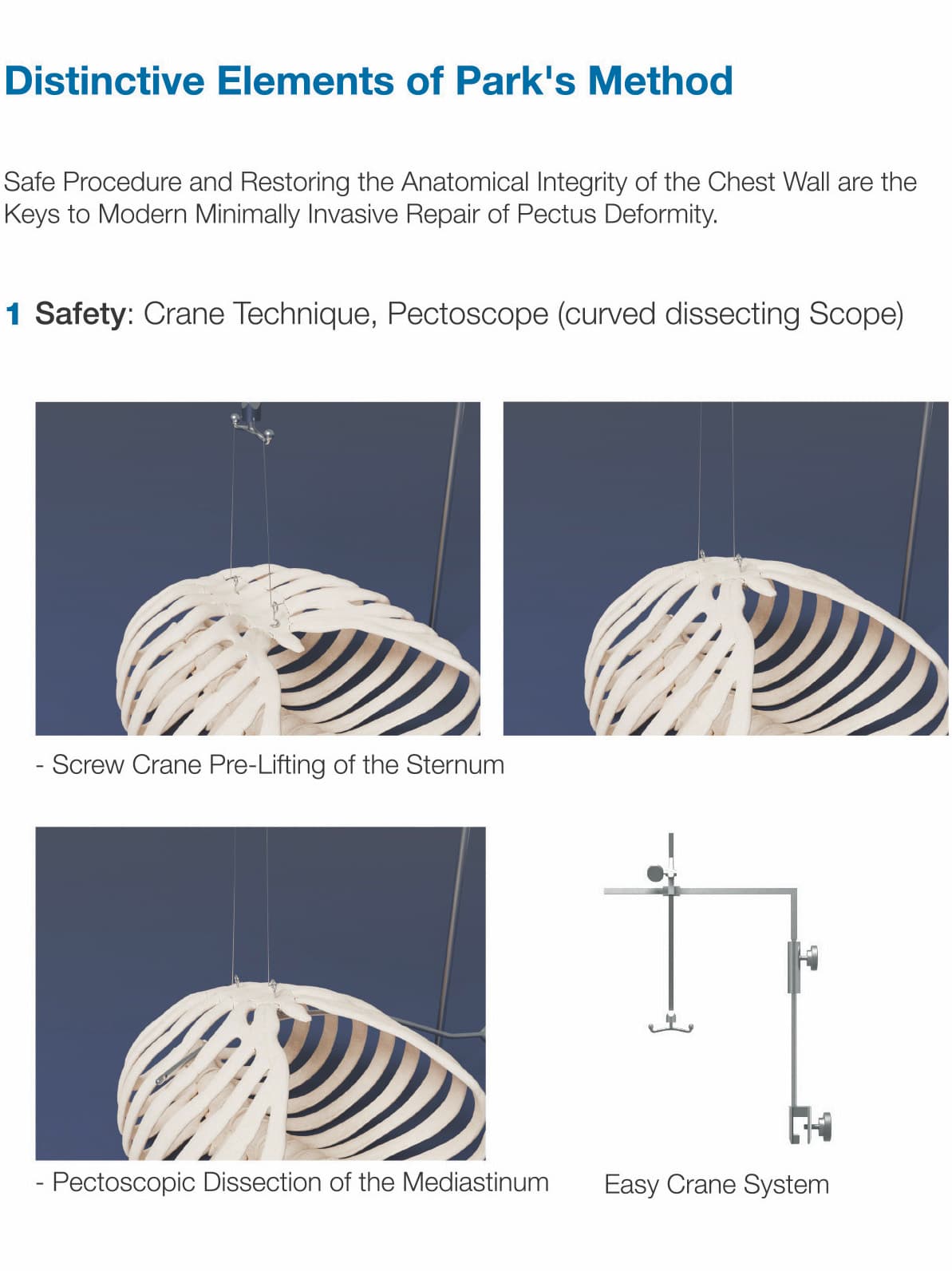 Park's Pectus System overview (4/7)