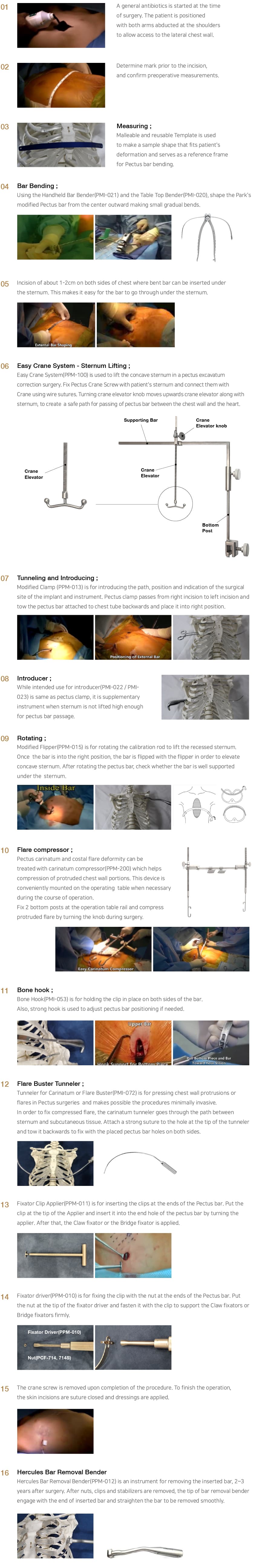 Park's Pectus System surgical technique (1/1)